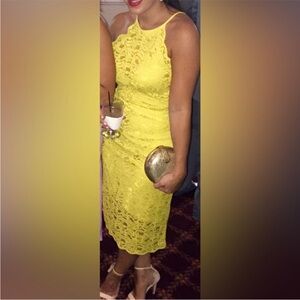 Zara Yellow Lace Overlay Dress